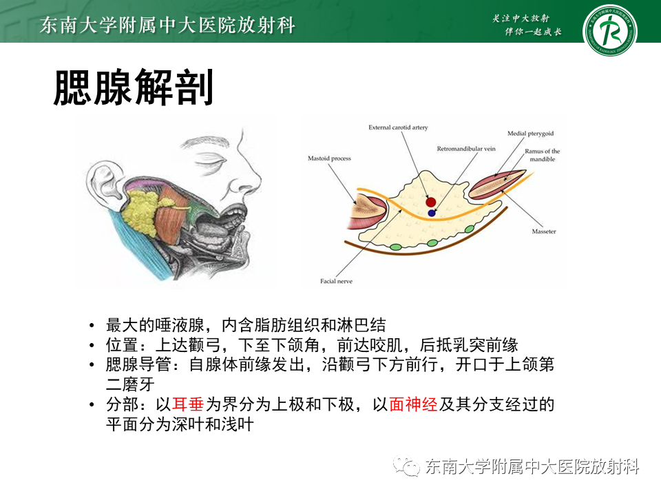 影像PPT - 【PPT】腮腺多形性腺瘤-6