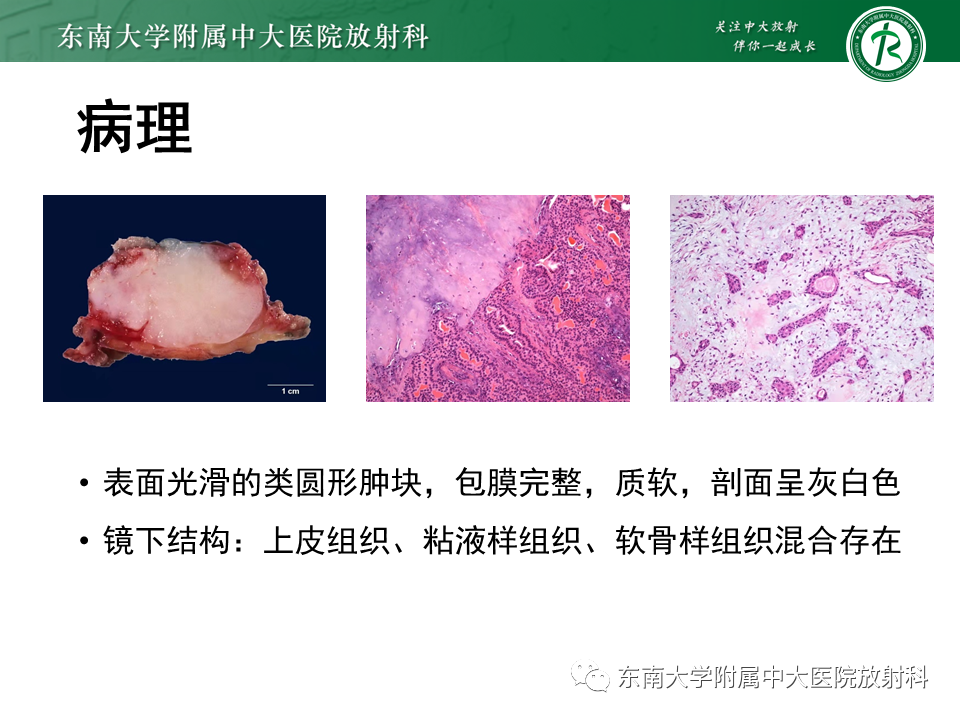 影像PPT - 【PPT】腮腺多形性腺瘤-9