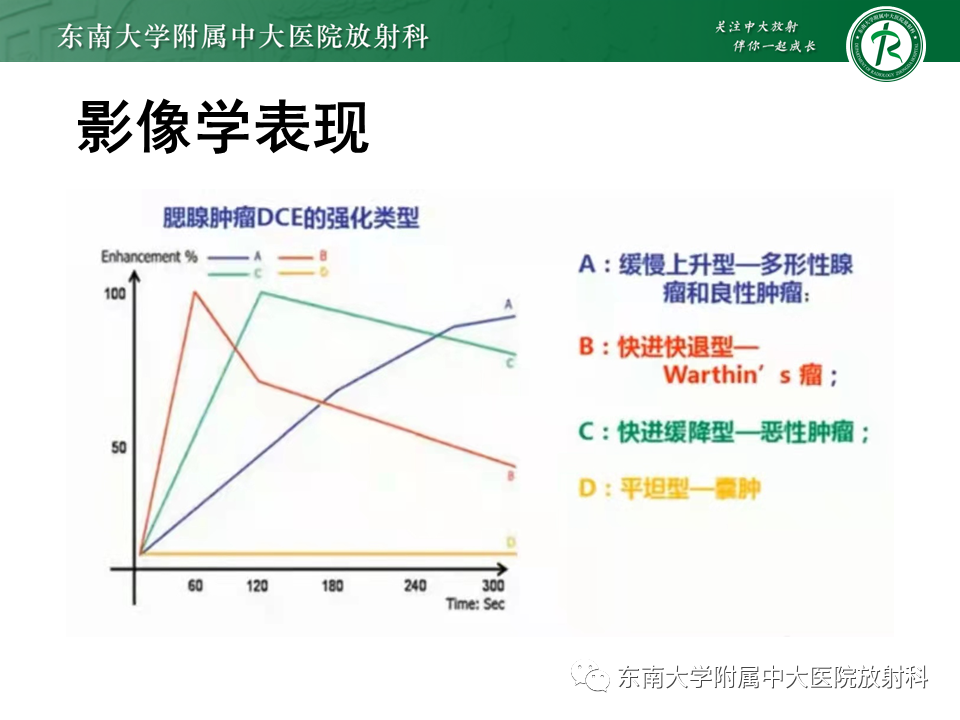 影像PPT - 【PPT】腮腺多形性腺瘤-19