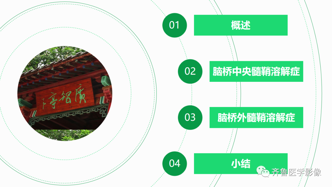 影像PPT - 【PPT】渗透性脱髓鞘综合征-7