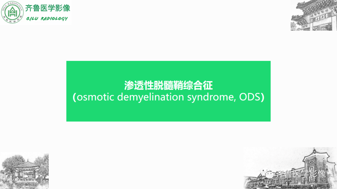 影像PPT - 【PPT】渗透性脱髓鞘综合征-6