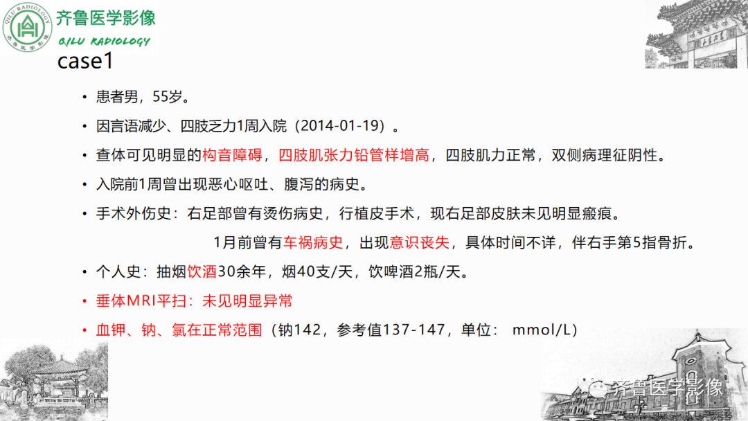 影像PPT - 【PPT】渗透性脱髓鞘综合征-2