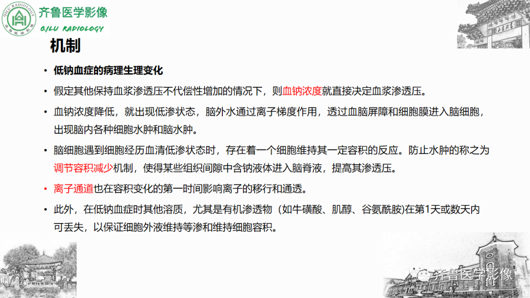 影像PPT - 【PPT】渗透性脱髓鞘综合征-12