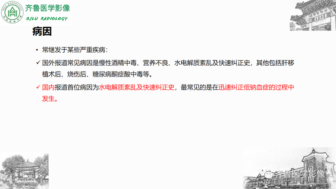 影像PPT - 【PPT】渗透性脱髓鞘综合征-11