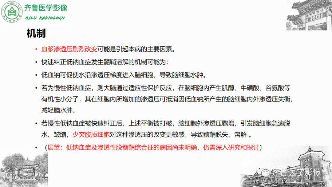 影像PPT - 【PPT】渗透性脱髓鞘综合征-13