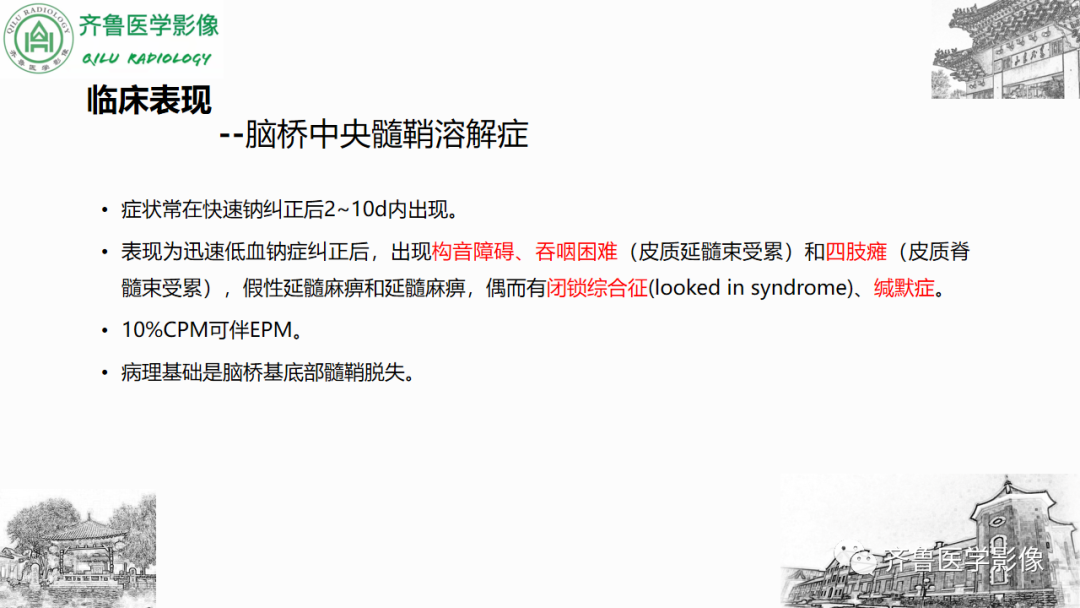 影像PPT - 【PPT】渗透性脱髓鞘综合征-16