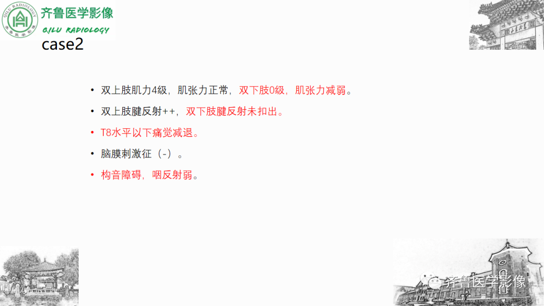 影像PPT - 【PPT】渗透性脱髓鞘综合征-23