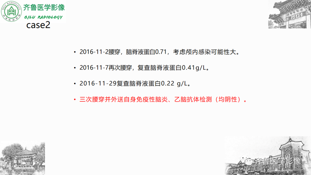影像PPT - 【PPT】渗透性脱髓鞘综合征-22