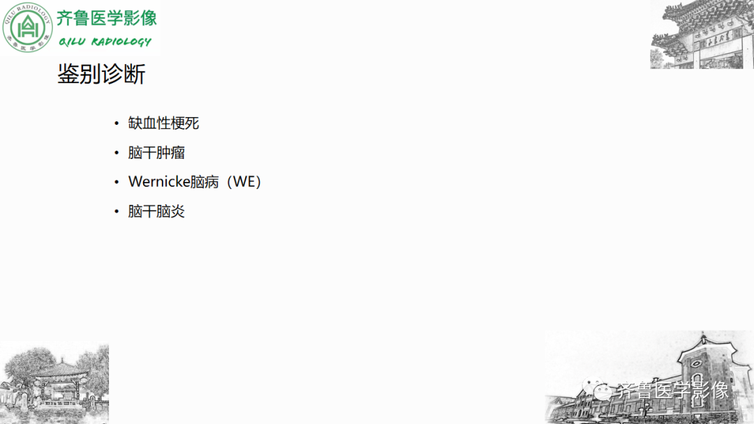 影像PPT - 【PPT】渗透性脱髓鞘综合征-29
