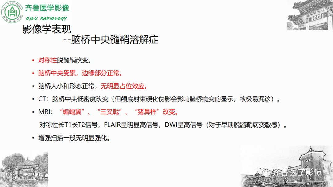 影像PPT - 【PPT】渗透性脱髓鞘综合征-28