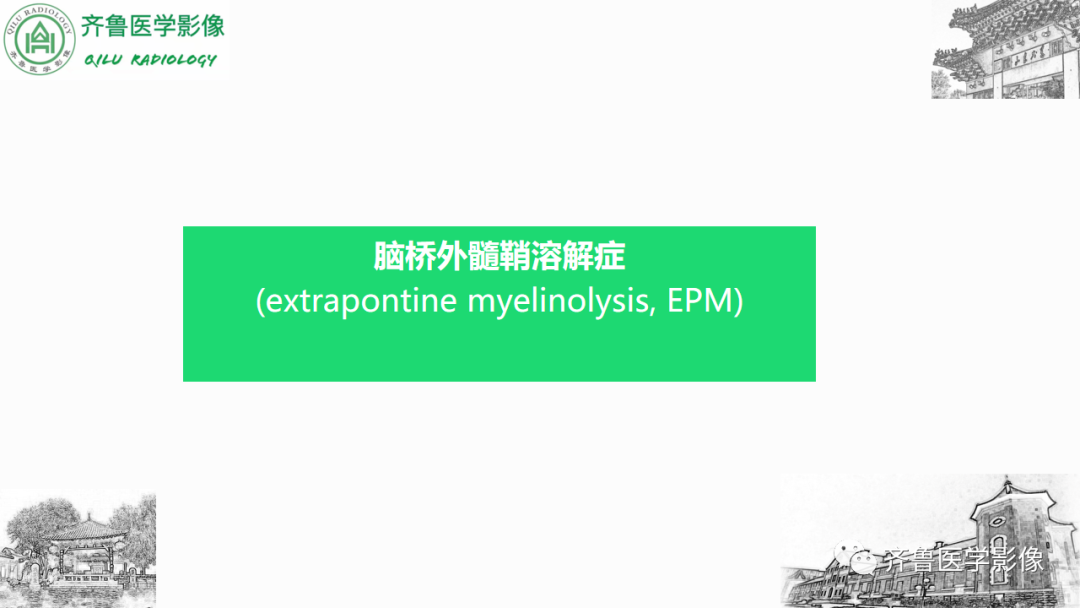影像PPT - 【PPT】渗透性脱髓鞘综合征-36