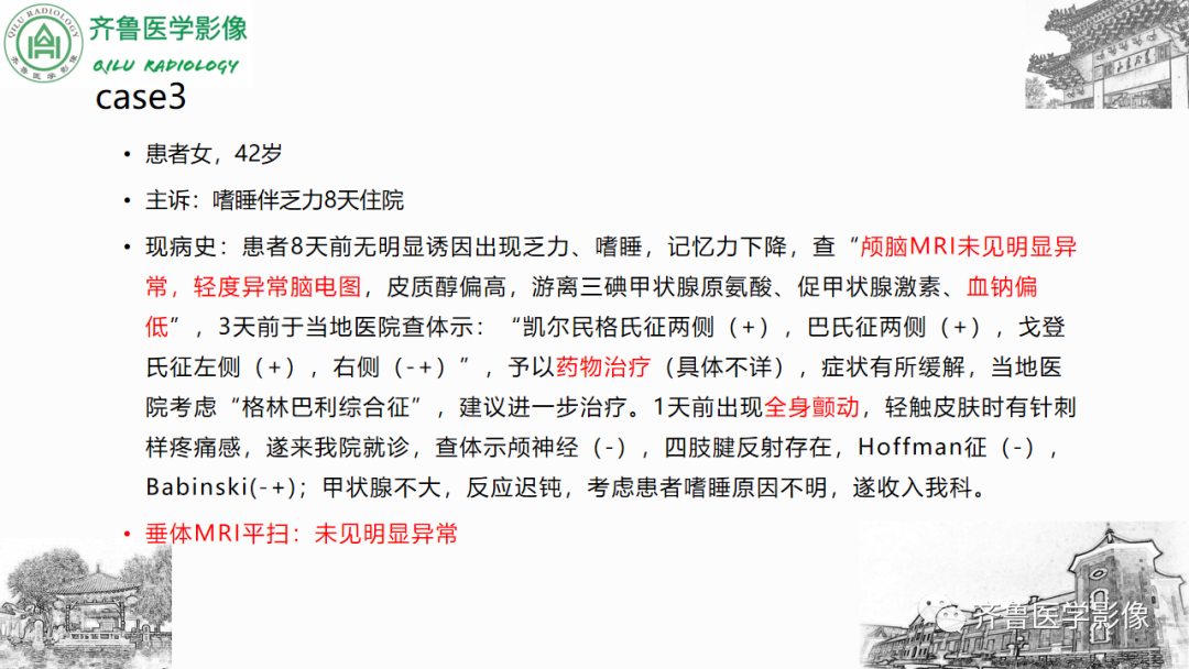 影像PPT - 【PPT】渗透性脱髓鞘综合征-37