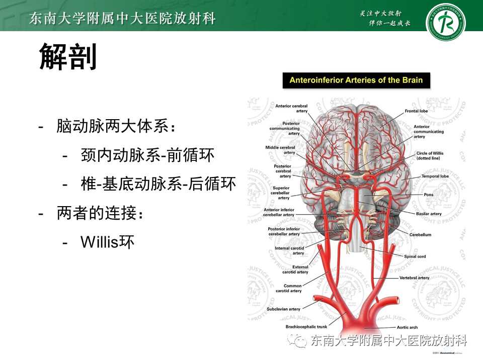 影像PPT - 【PPT】颅内动脉瘤-4