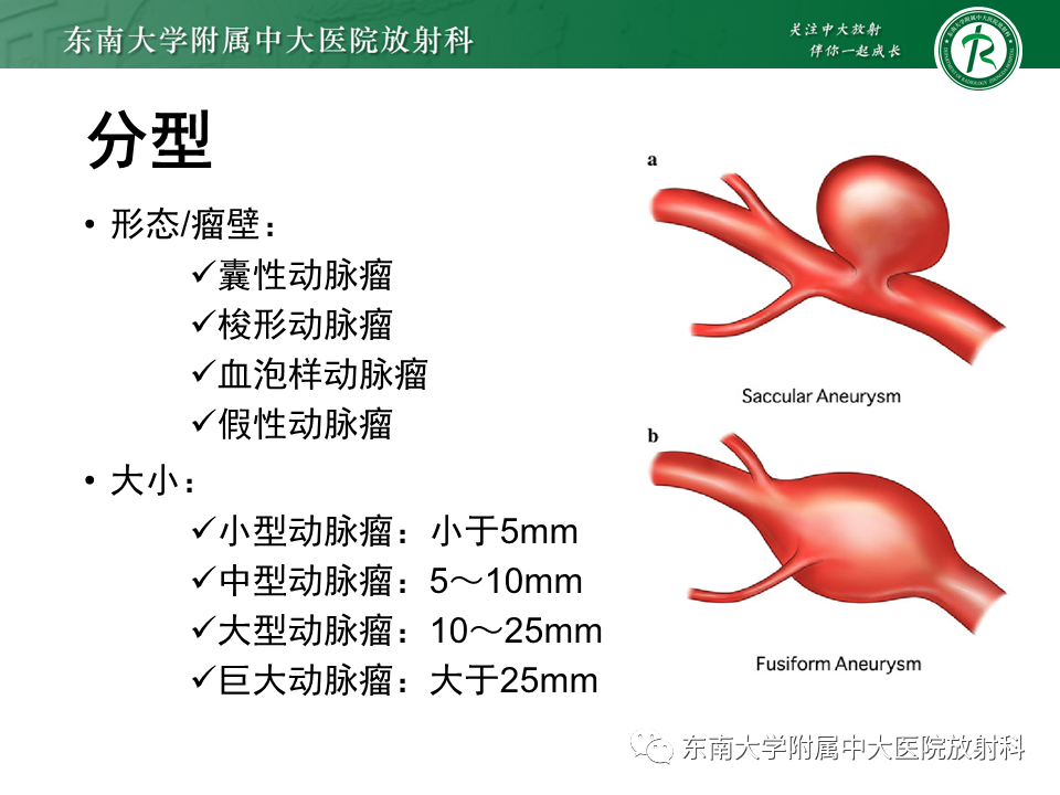 影像PPT - 【PPT】颅内动脉瘤-9
