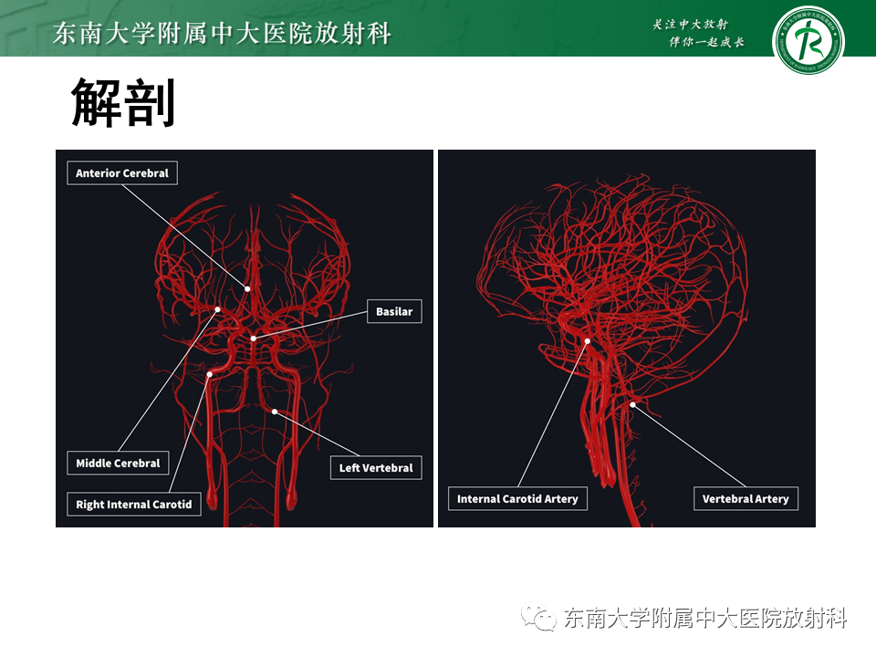 影像PPT - 【PPT】颅内动脉瘤-5