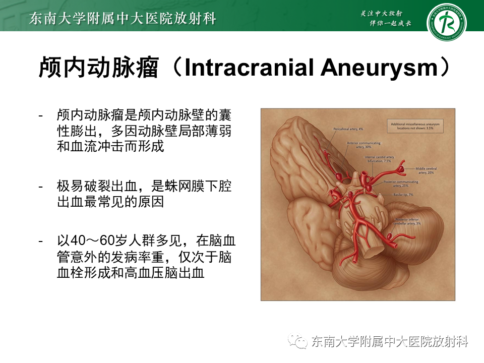 影像PPT - 【PPT】颅内动脉瘤-7
