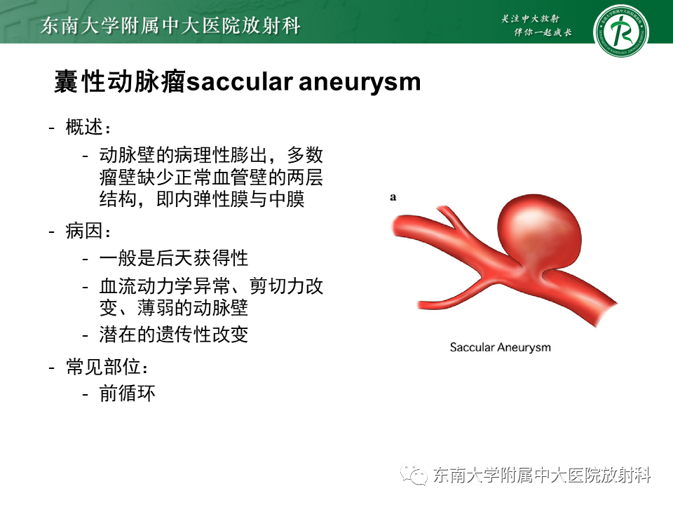 影像PPT - 【PPT】颅内动脉瘤-11