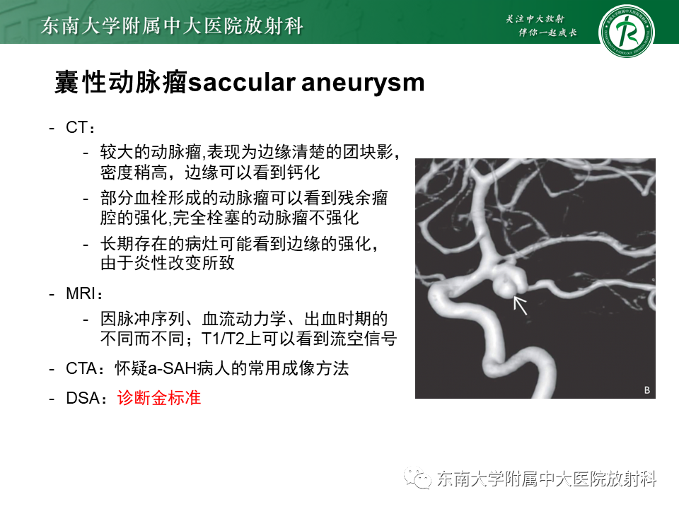 影像PPT - 【PPT】颅内动脉瘤-15