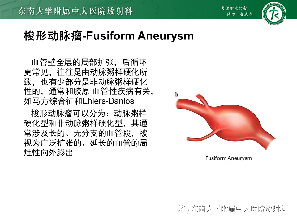 影像PPT - 【PPT】颅内动脉瘤-21