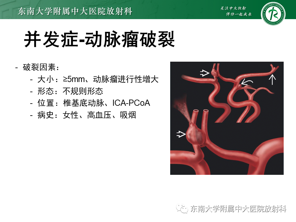 影像PPT - 【PPT】颅内动脉瘤-30