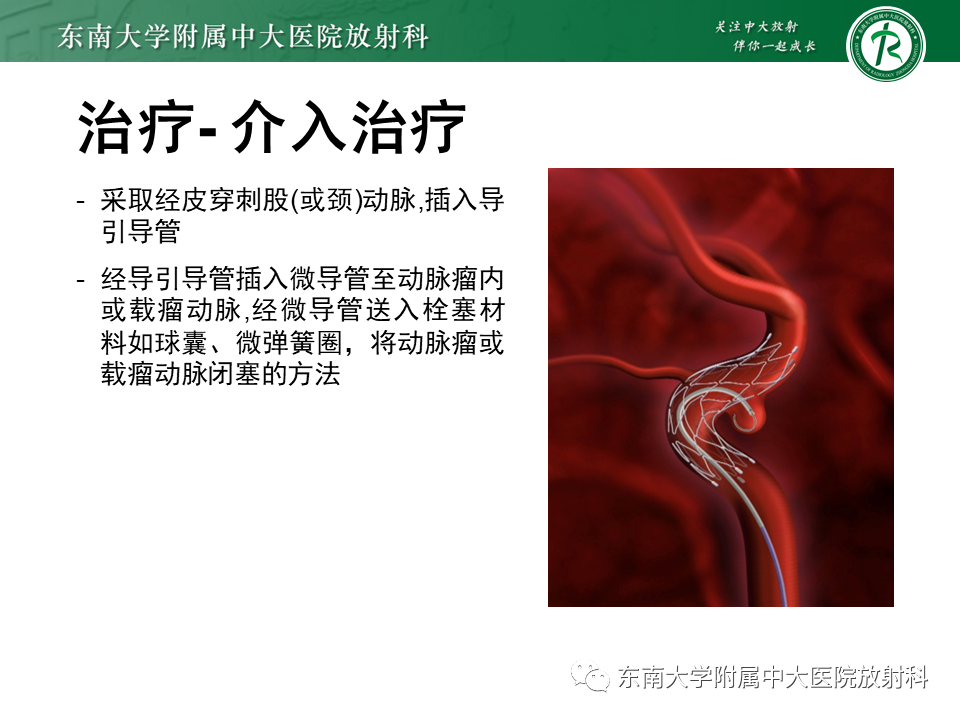 影像PPT - 【PPT】颅内动脉瘤-35