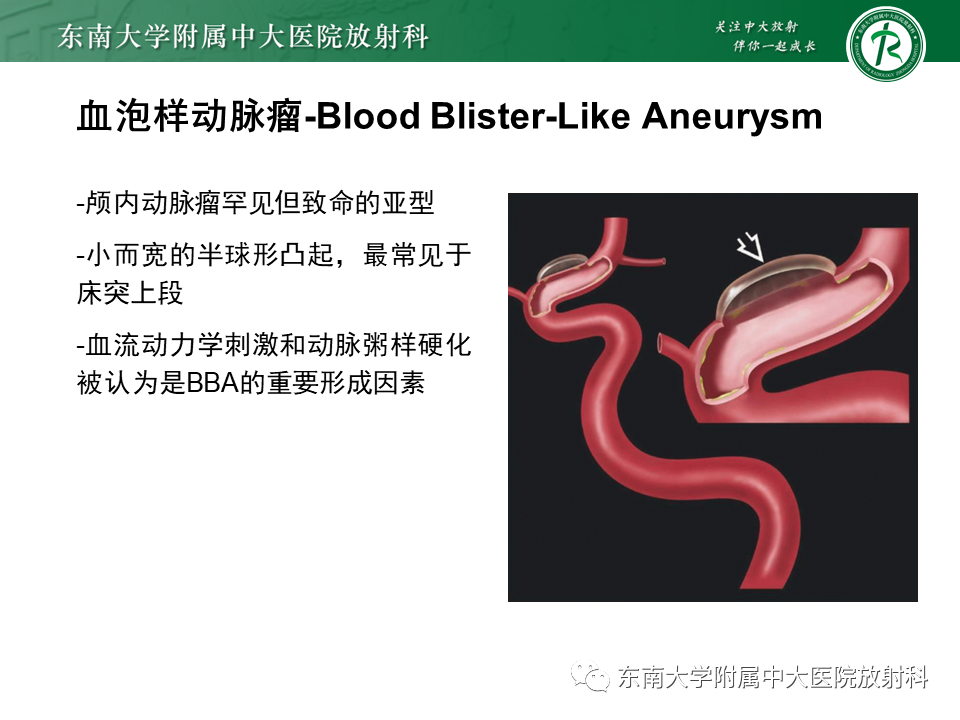 影像PPT - 【PPT】颅内动脉瘤-25