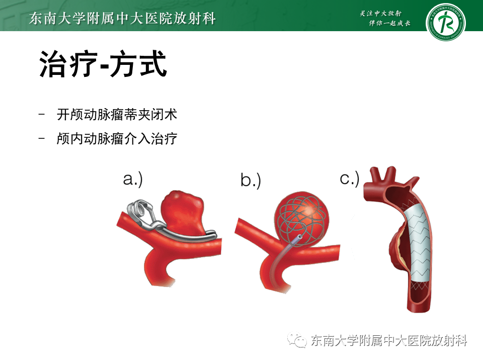 影像PPT - 【PPT】颅内动脉瘤-34