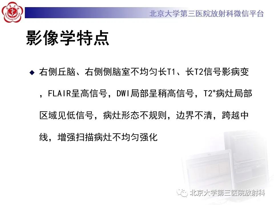 影像PPT - 【PPT】胶质母细胞瘤-6