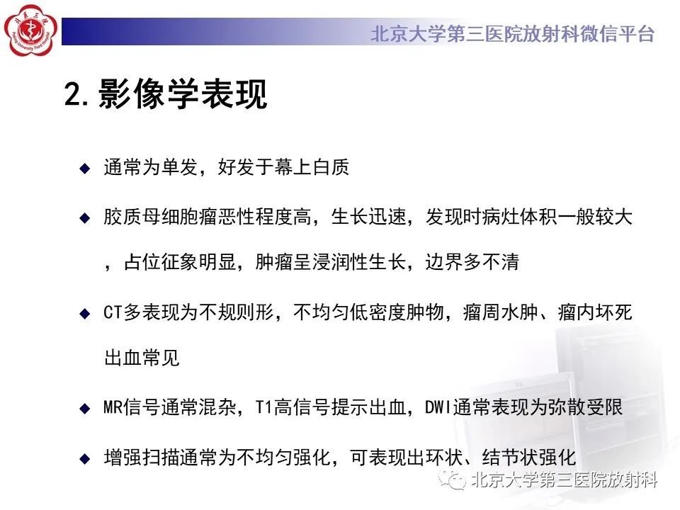 影像PPT - 【PPT】胶质母细胞瘤-11