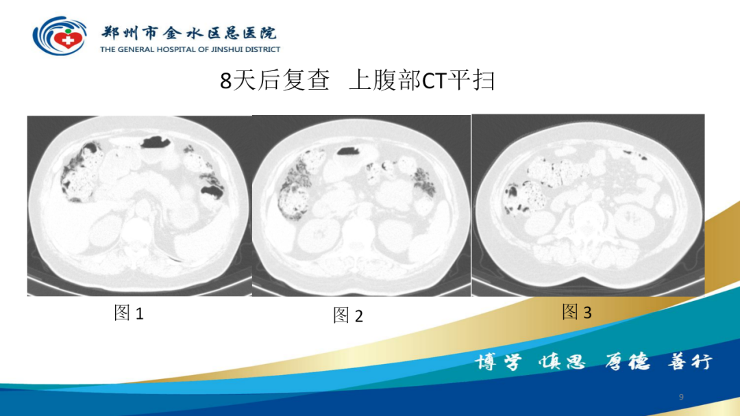 影像PPT - 【病例】肠壁囊样积气症-9