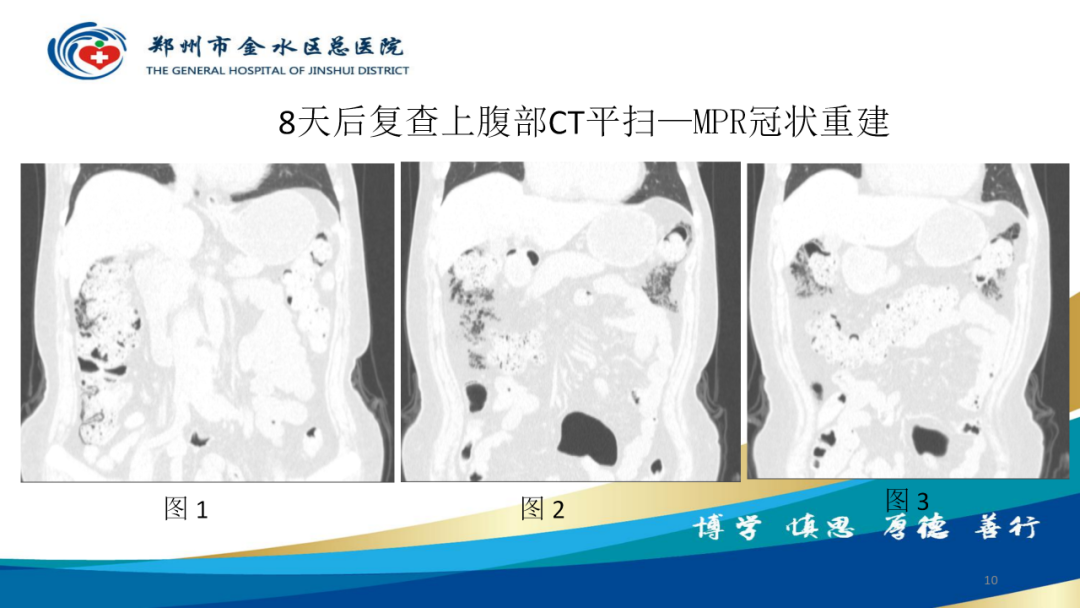 影像PPT - 【病例】肠壁囊样积气症-10
