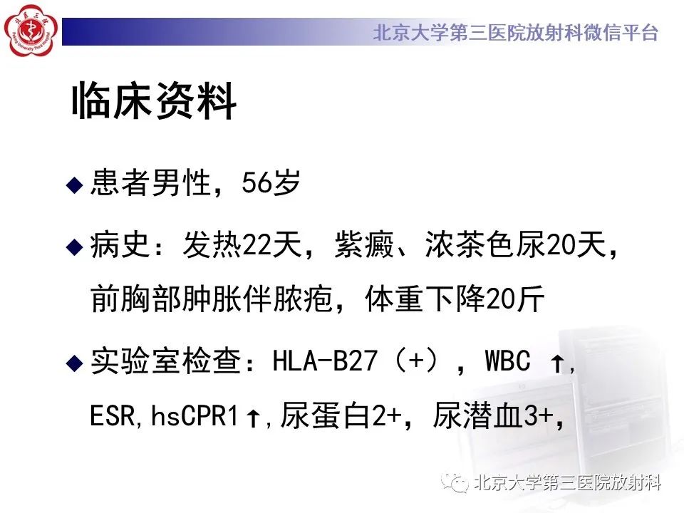 影像PPT - 【PPT】SAPHO综合征-2