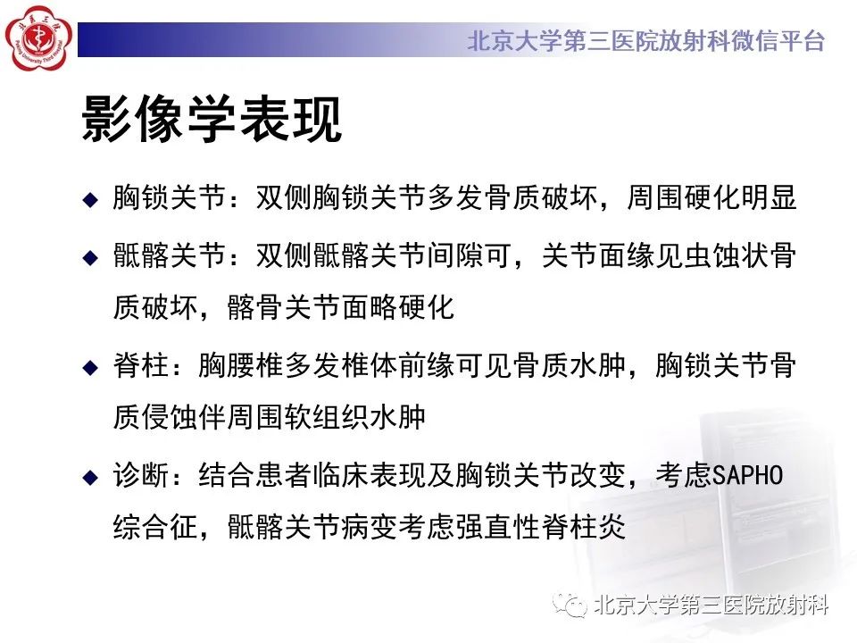 影像PPT - 【PPT】SAPHO综合征-9