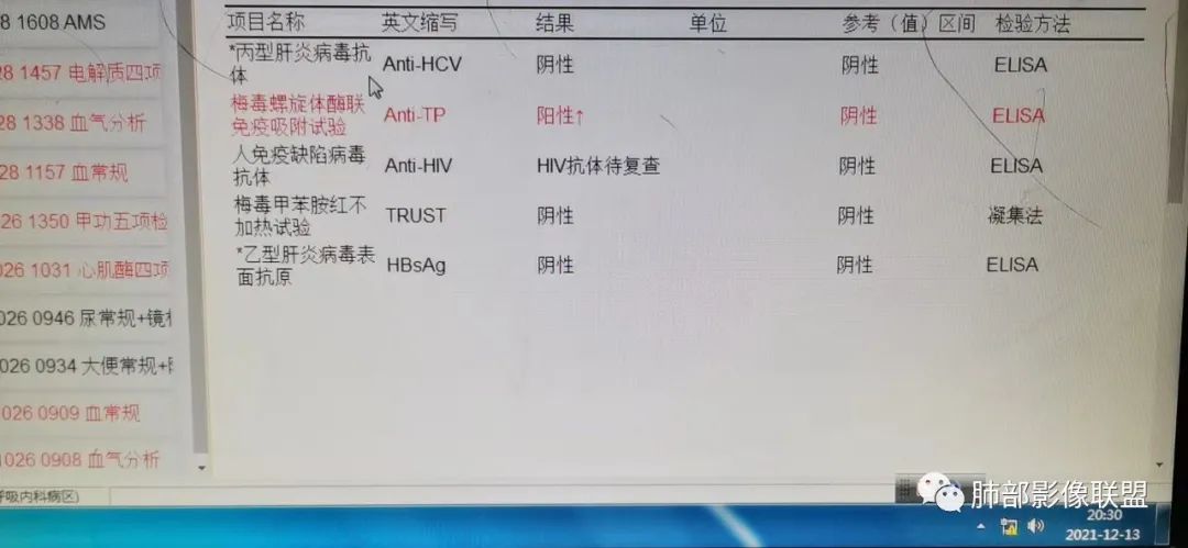 影像PPT - 【PPT】因“艾”而“生”—教你读懂马尔尼菲篮状菌-20 影像PPT - 【PPT】因“艾”而“生”—教你读懂马尔尼菲篮状菌-20