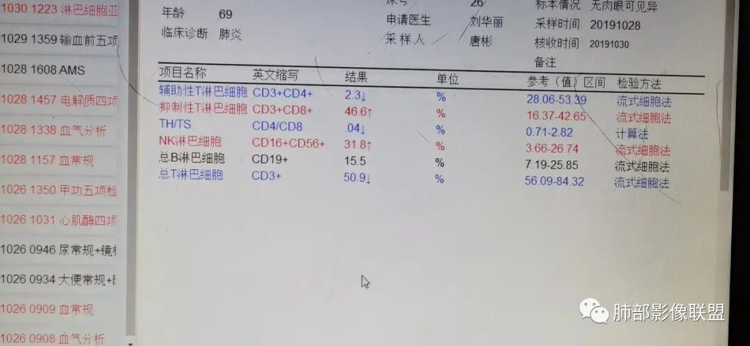 影像PPT - 【PPT】因“艾”而“生”—教你读懂马尔尼菲篮状菌-21 影像PPT - 【PPT】因“艾”而“生”—教你读懂马尔尼菲篮状菌-21