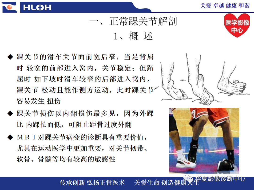 影像PPT - 【PPT】踝关节病变的MRI诊断-4