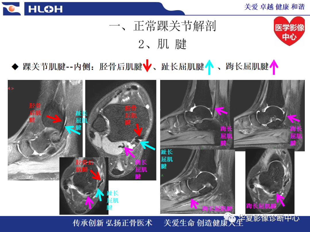 影像PPT - 【PPT】踝关节病变的MRI诊断-7