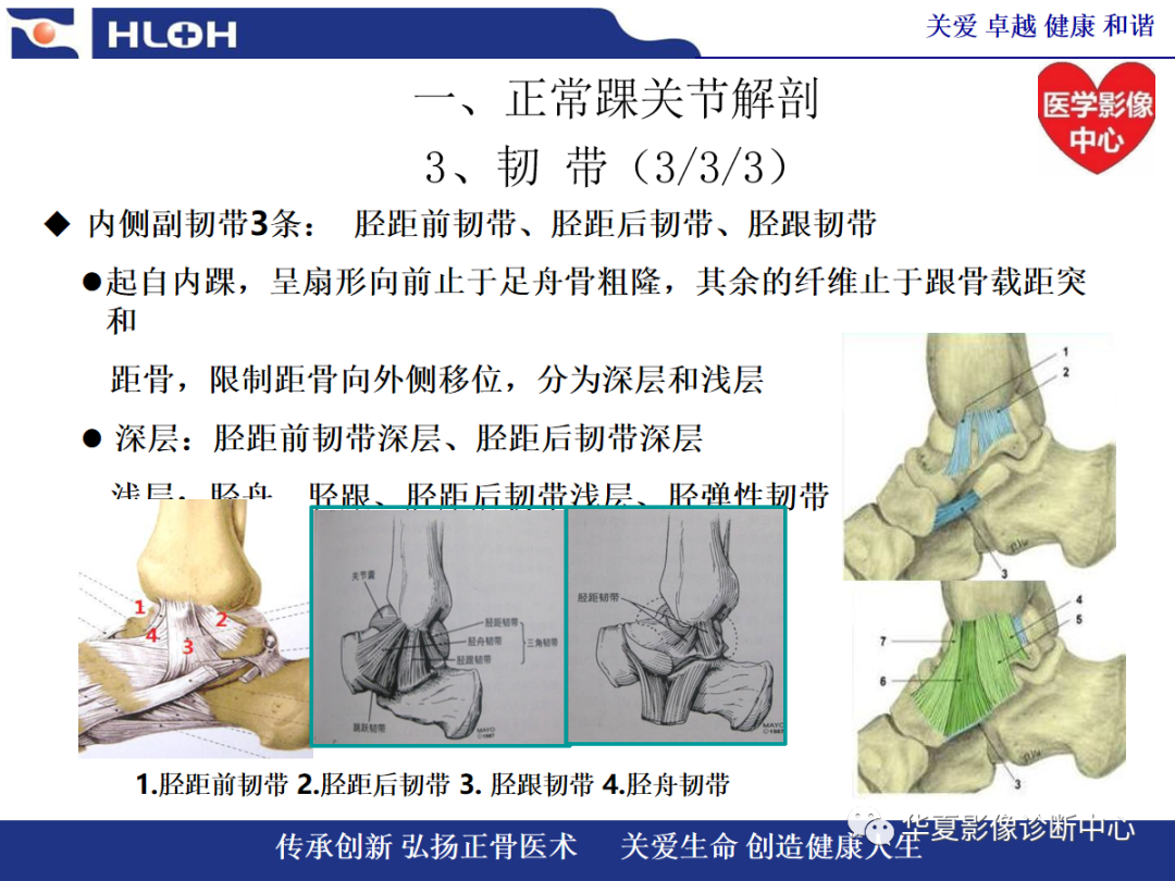 影像PPT - 【PPT】踝关节病变的MRI诊断-15