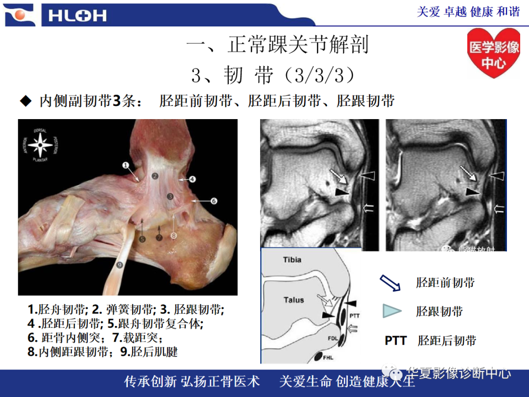 影像PPT - 【PPT】踝关节病变的MRI诊断-16