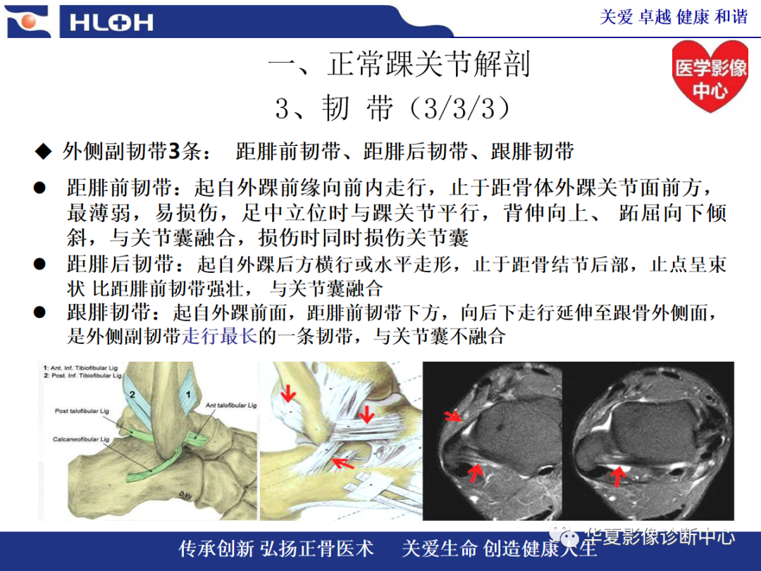影像PPT - 【PPT】踝关节病变的MRI诊断-19
