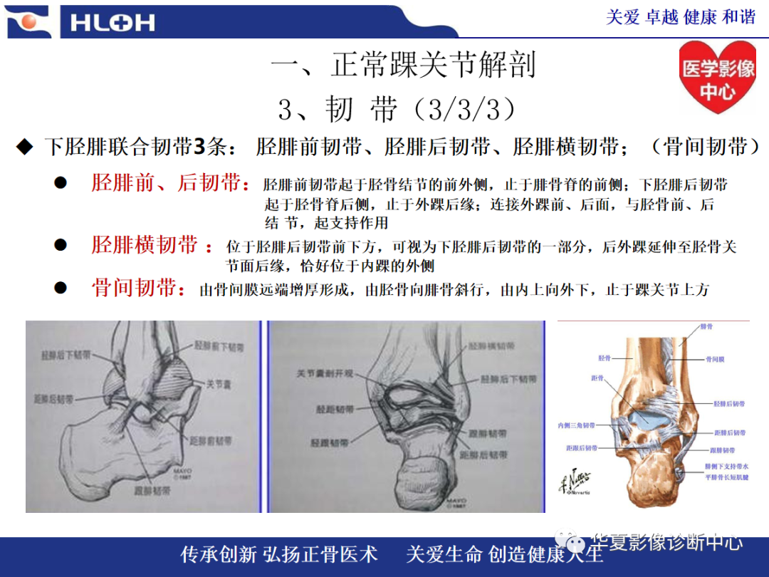 影像PPT - 【PPT】踝关节病变的MRI诊断-22