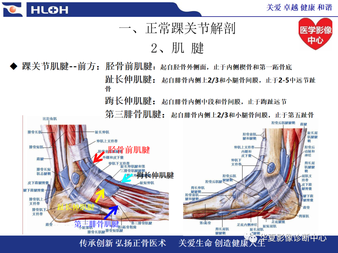影像PPT - 【PPT】踝关节病变的MRI诊断-10