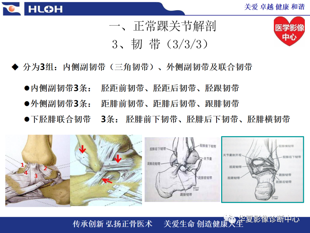 影像PPT - 【PPT】踝关节病变的MRI诊断-14