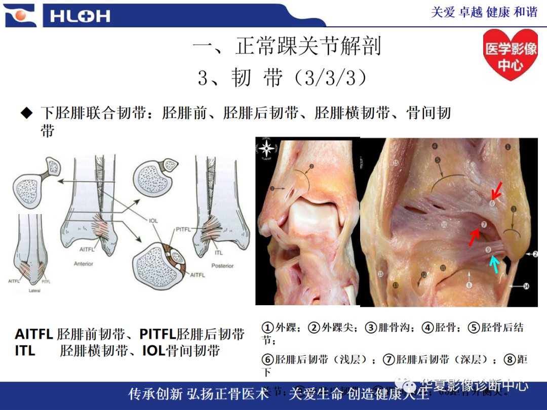 影像PPT - 【PPT】踝关节病变的MRI诊断-23