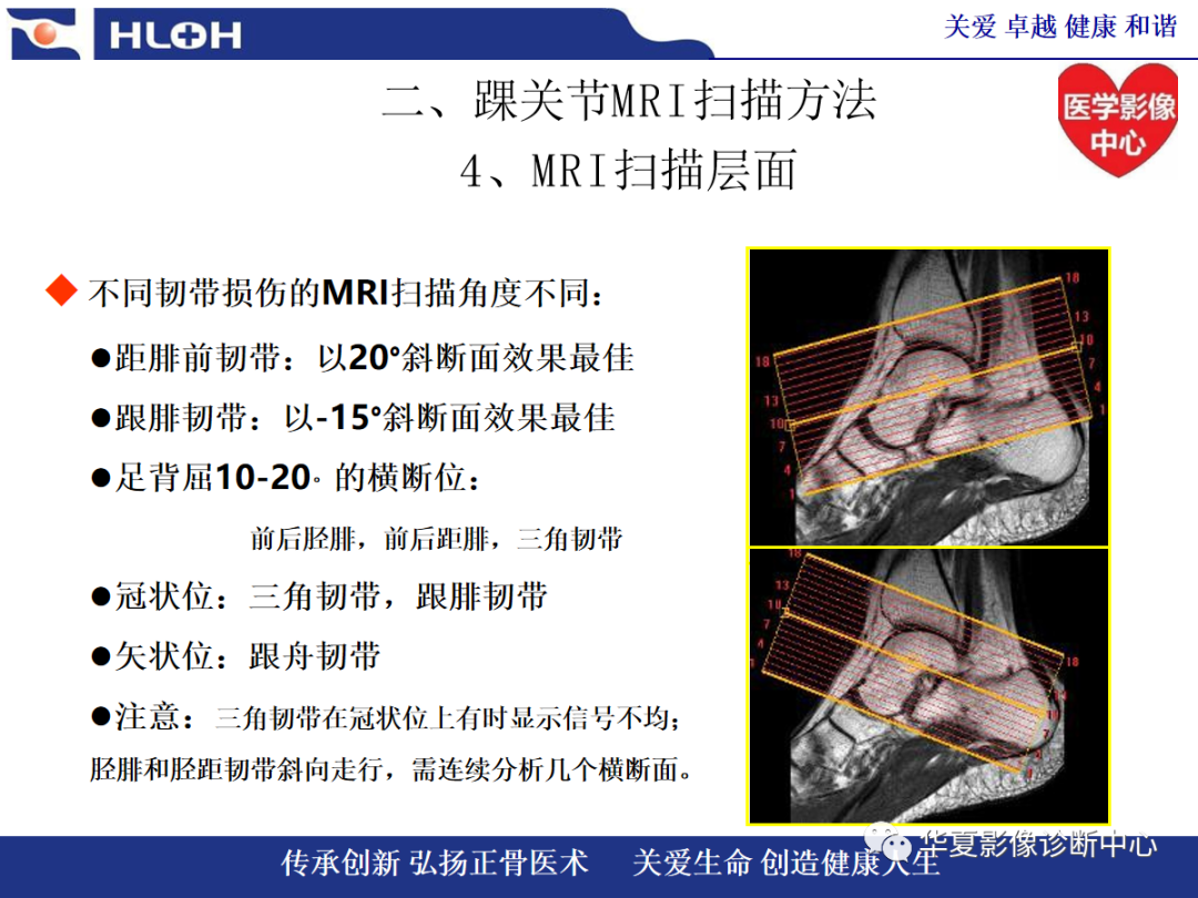 影像PPT - 【PPT】踝关节病变的MRI诊断-31