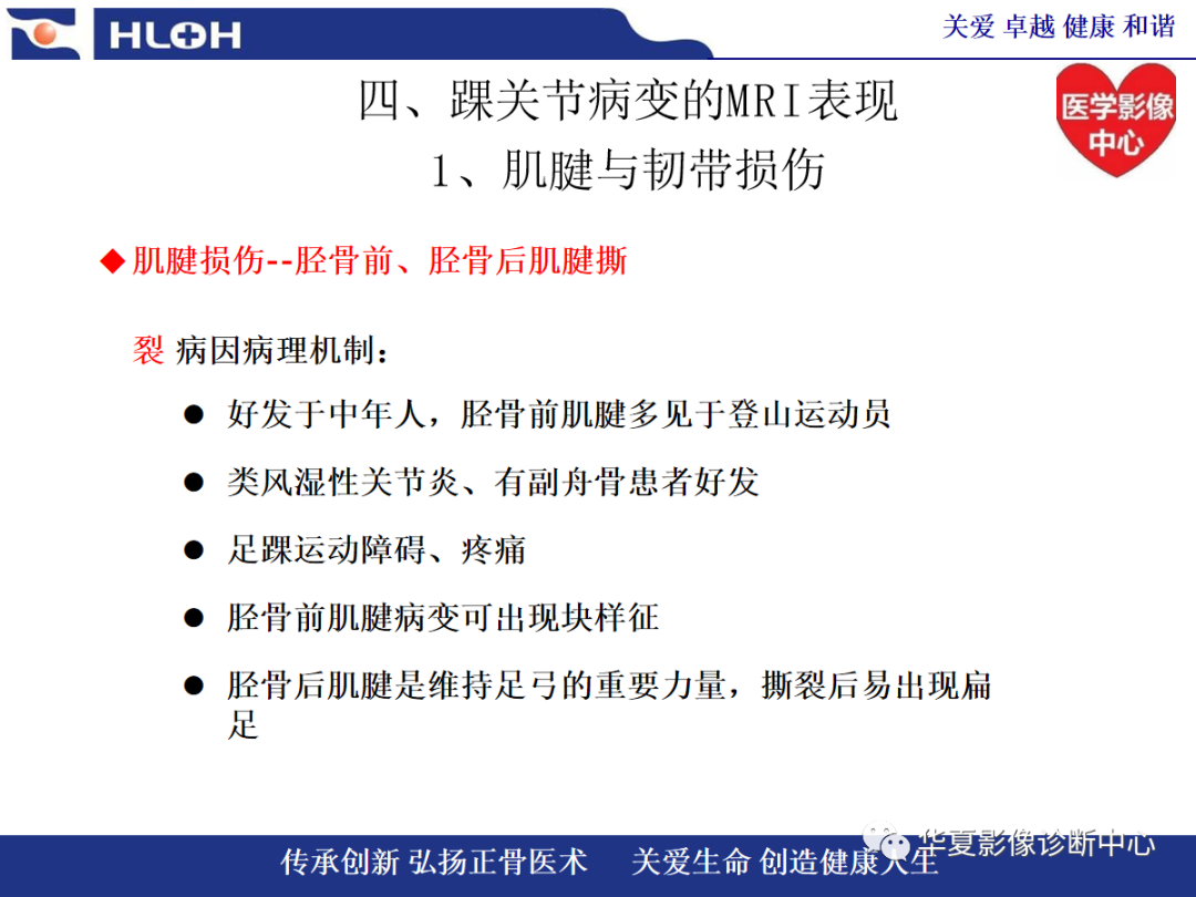 影像PPT - 【PPT】踝关节病变的MRI诊断-40