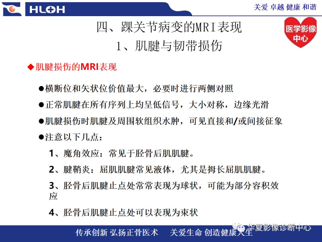 影像PPT - 【PPT】踝关节病变的MRI诊断-36