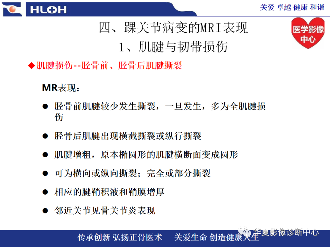 影像PPT - 【PPT】踝关节病变的MRI诊断-41