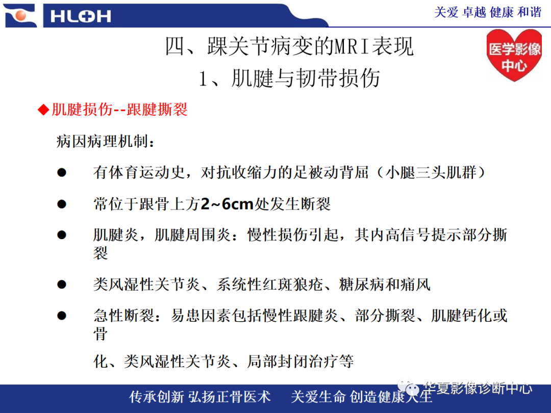 影像PPT - 【PPT】踝关节病变的MRI诊断-50