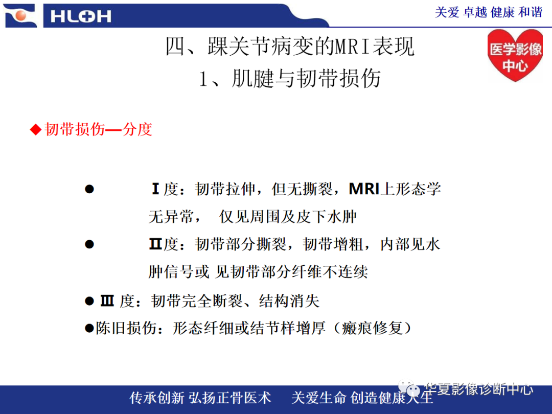 影像PPT - 【PPT】踝关节病变的MRI诊断-60